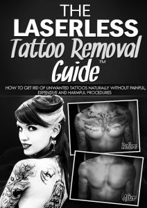 The Laserless Tattoo Removal Guide